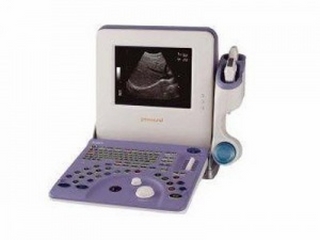 Máy siêu âm xách tay Aloka Prosound 2